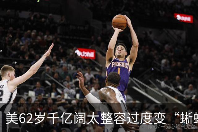 美62岁千亿阔太整容过度变“蜥蜴人”？与丈夫豪捐百亿压不住负评，网友：花钱故意整丑？
